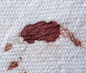 blood-stain